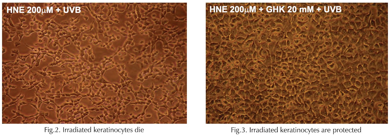 Aldenine protective effect